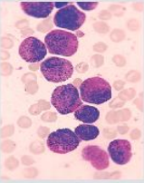 blood smear image