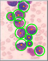 Blood Cell Detection