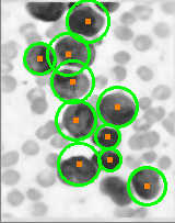 Modified Haugh Transformation for circle detection