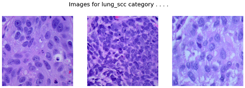 Images for lung_scc category