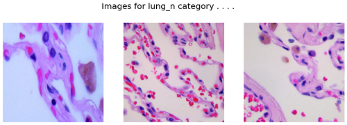 Lung Cancer Detection using Convolutional Neural Network (CNN) -  GeeksforGeeks