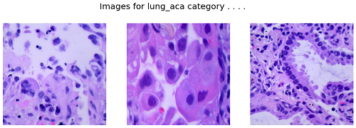 Images for lung_aca category