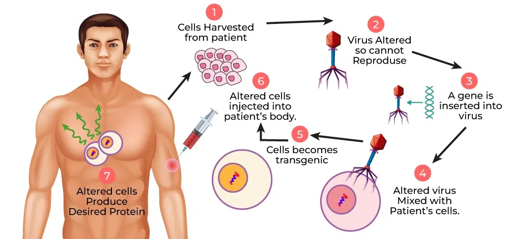 Gene Therapy