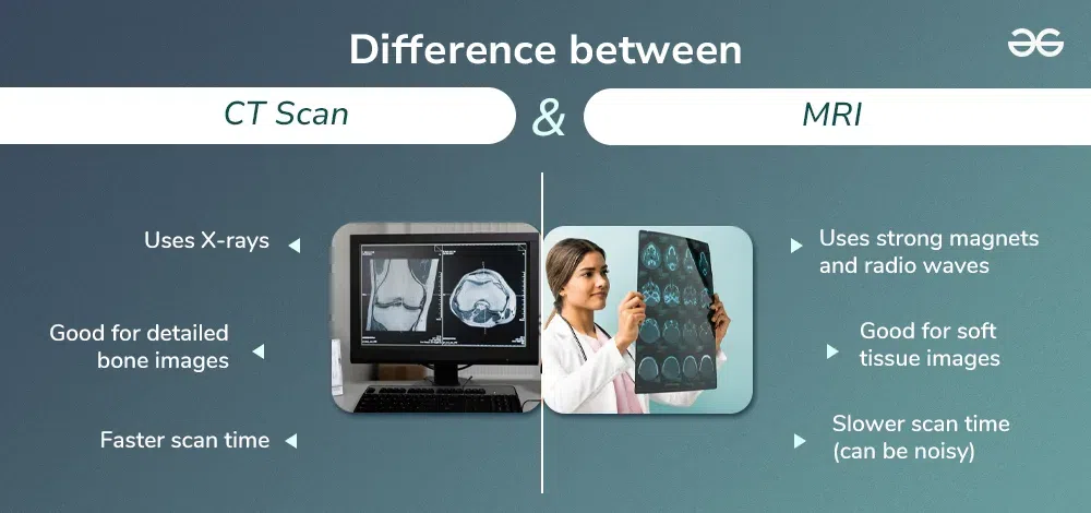 Difference-Between-CT-Scan-and-MRI-