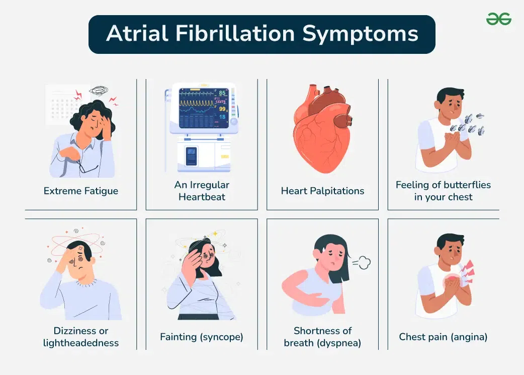 Atrial Fibrillation Stroke Treatment – SYYVOE