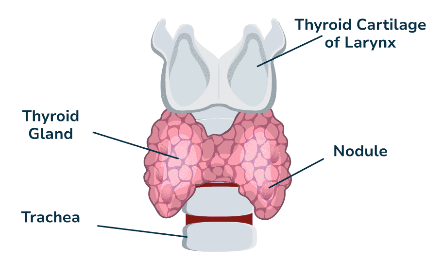 Thyroid-Glands2