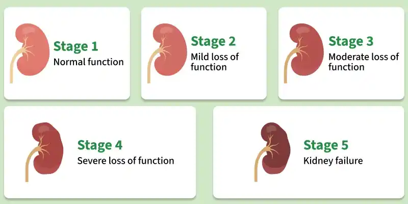 stages_of_chronic_kidney_disease